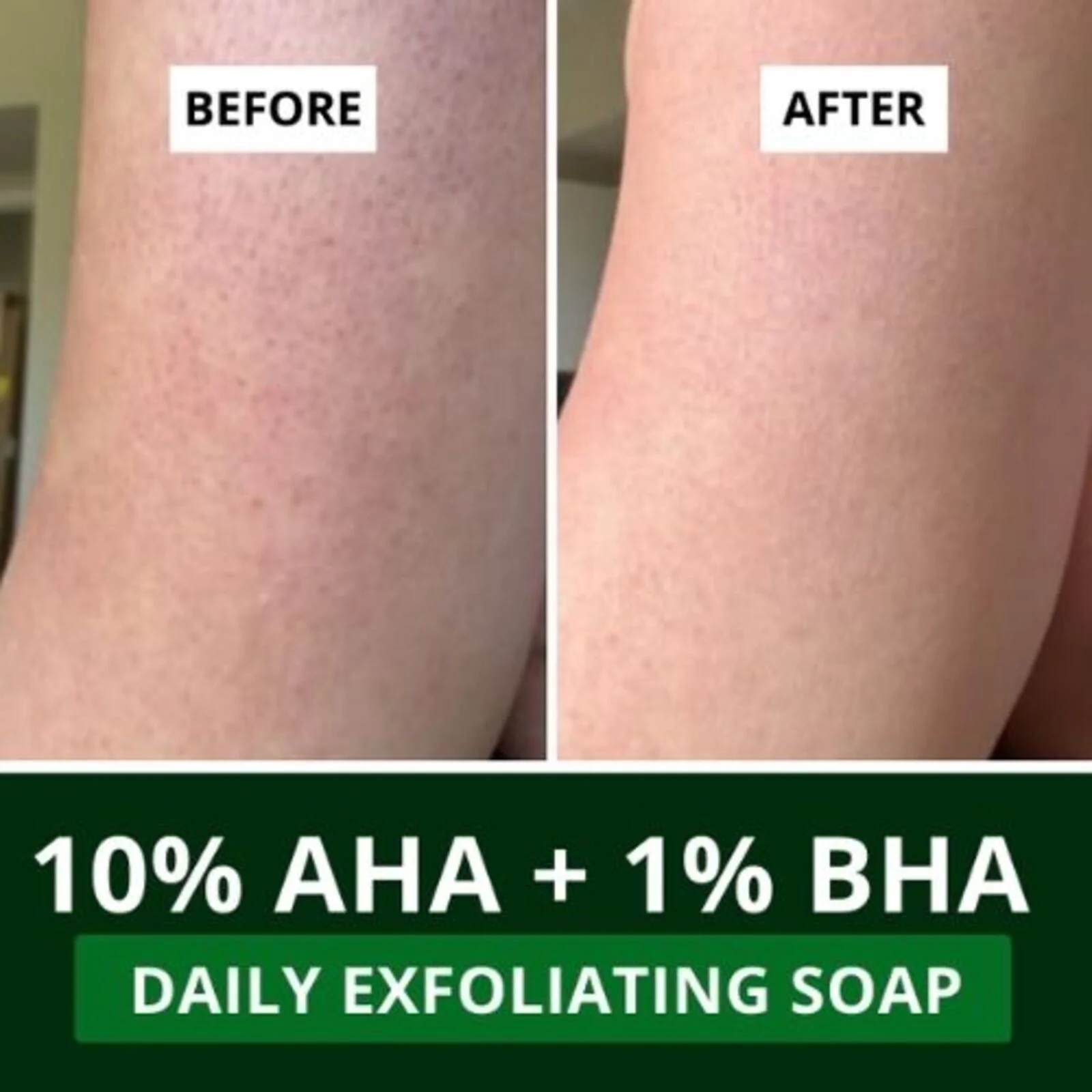 10% AHA + 1% BHA Scrub Treatment Soap (Pack of 3, 300g) - Image 4