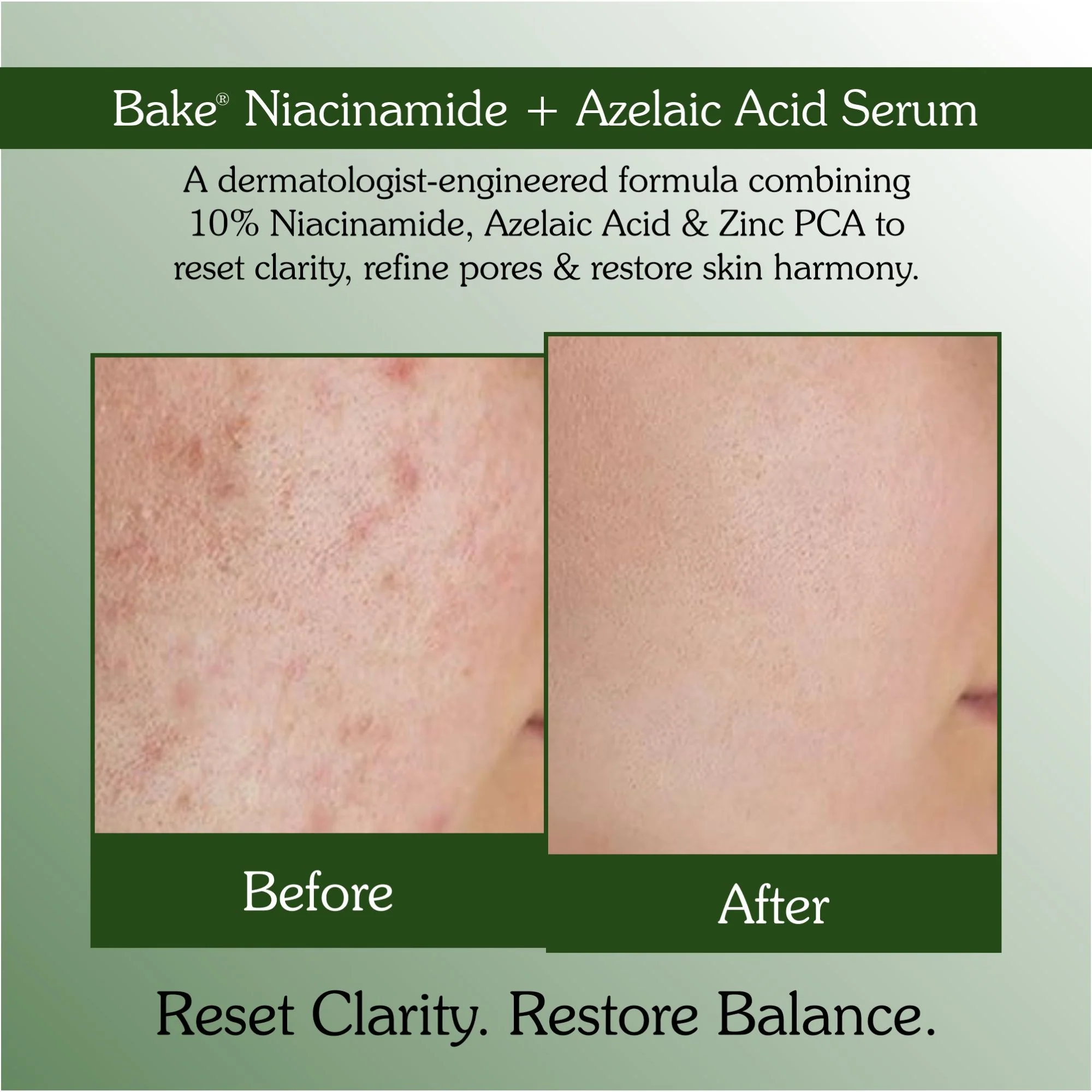 10% Niacinamide + Azelaic Acid Clarifying Serum - Image 4