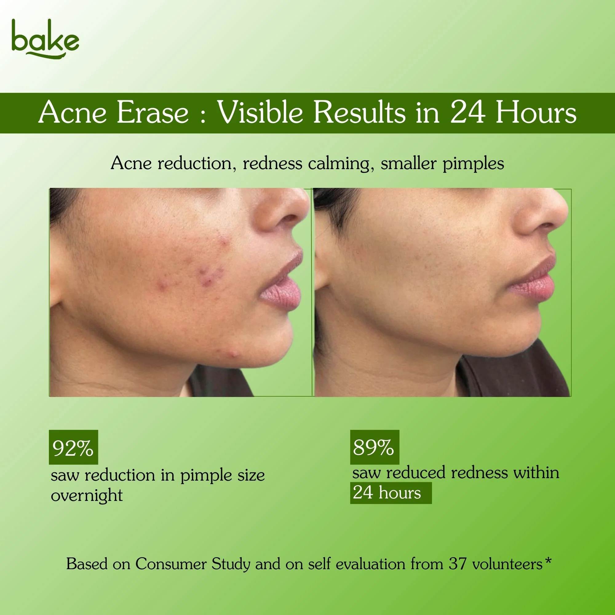 Acne Erase Overnight Spot Corrector Cream - Image 5