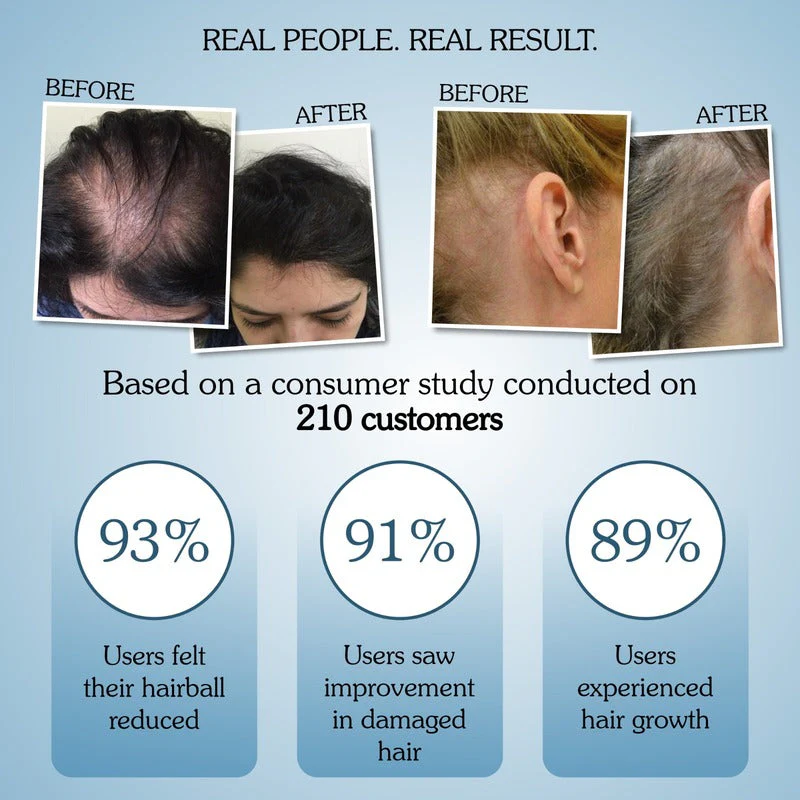 Rosemary Water Hair Growth Spray with Multi Peptides - Image 5